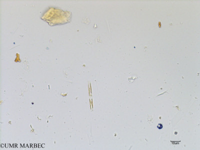 phyto/Scattered_Islands/mayotte_lagoon/SIREME May 2016/Leptocylindrus sp1 (MAY5_cf navicula-2).tif(copy)_thumb.jpg